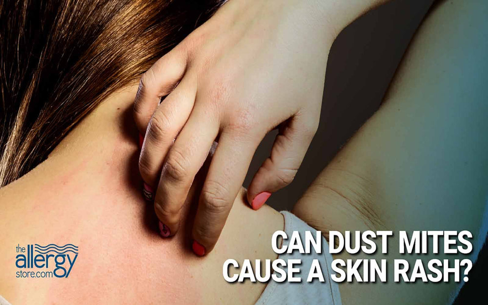 Can Dust Mites Cause a Skin Rash?