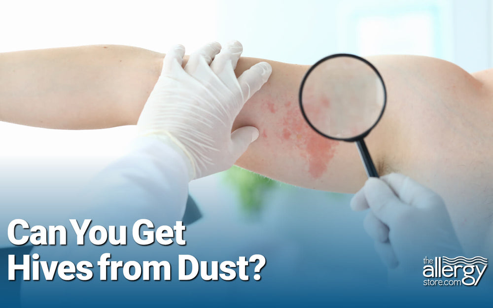 Can household dust cause hives?