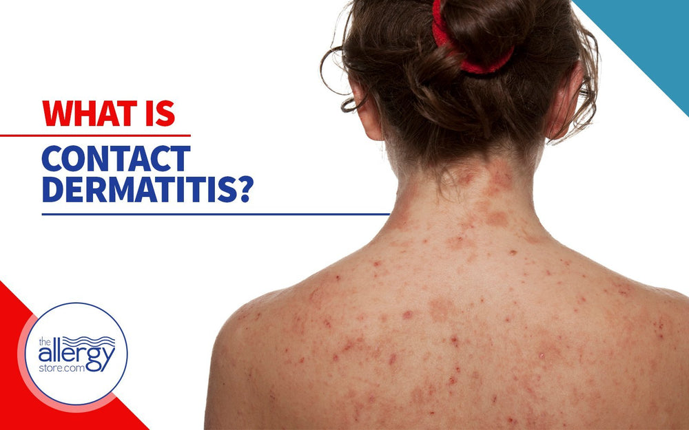 What Is Contact Dermatitis?