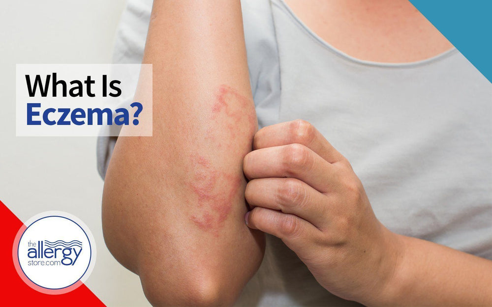 What is Eczema?