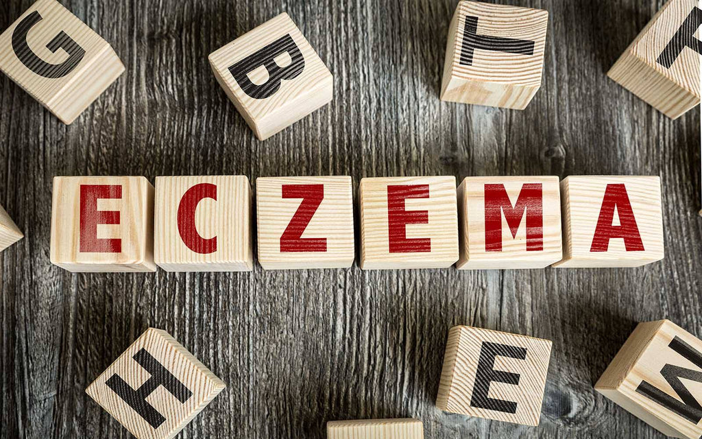 5 Easy Ways to Treat Eczema