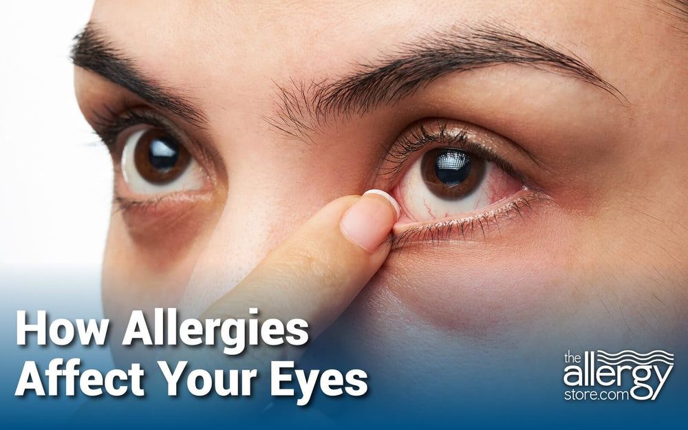 pollen allergy swollen eyes