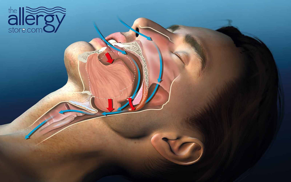Snoring Explained Unmasking the Mystery: Why Do I Snore?